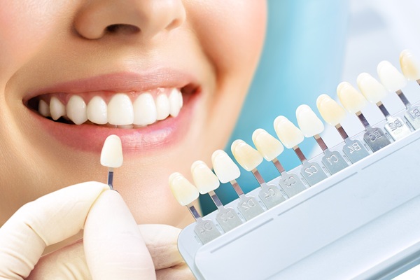 How Dentists Can Make Dental Veneers Look More Natural